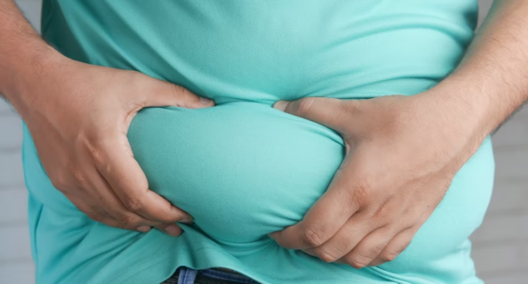 Endoskopi Bariatrik Jadi Alternatif Atasi Obesitas, Berikut Penjelasan Dokter Ahli